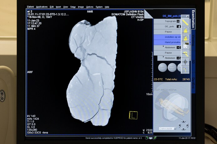 70 miljoen jaar later toont CT-scanner in JBZ mogelijk embryo baby-dino ...