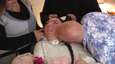 Vrouw die bijna geen hersenen heeft en nooit ouder zou worden dan 4 jaar viert 20ste verjaardag: ‘Mirakel’