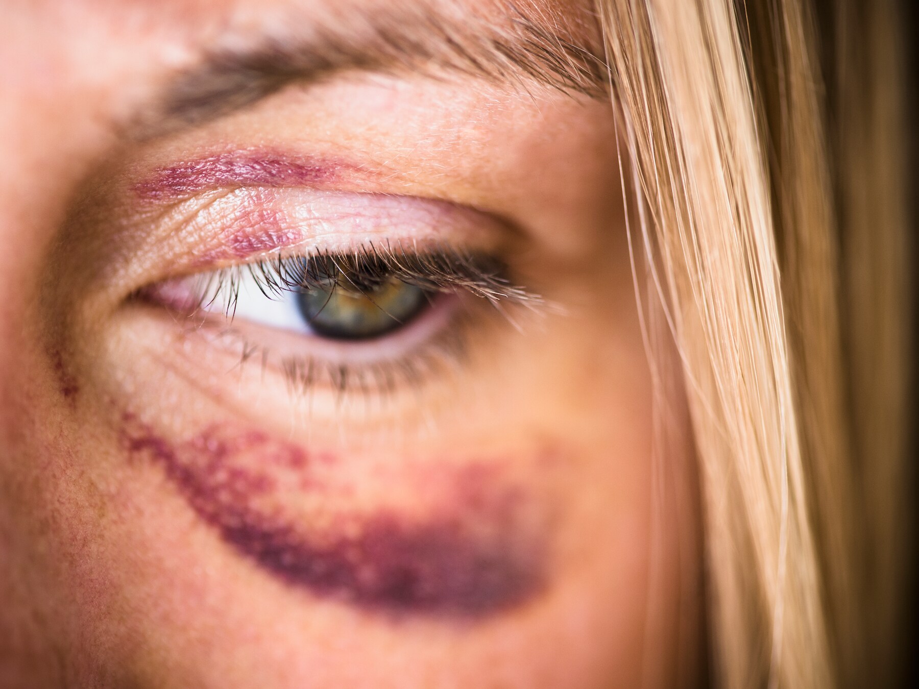 Slachtoffers huiselijk geweld hebben nu een plek om zonder afspraak binnen te lopen in Tilburg: ‘Laagdrempelige hulp’  